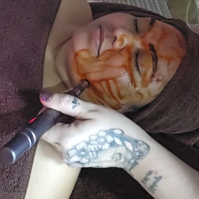 RevitaPen Pro Package 